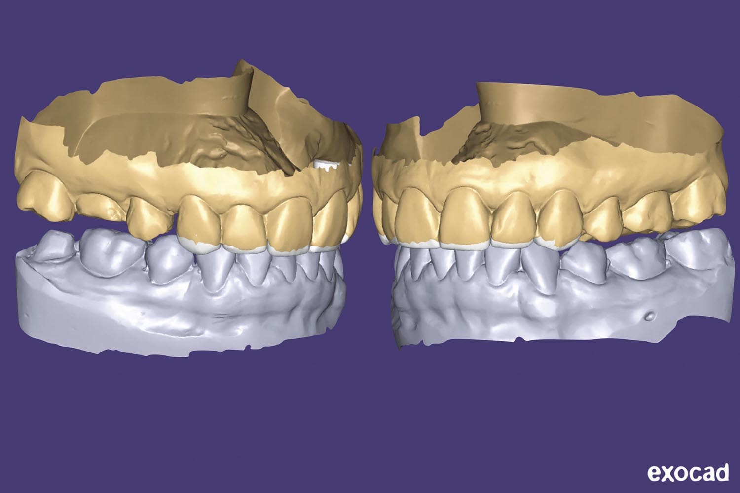 DOOR - Rehabilitation orthodontic guidance device. Part I